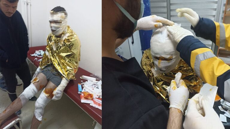 Erzurum’da Kömür Ocağında Yangın: 2 İşçi Yaralı