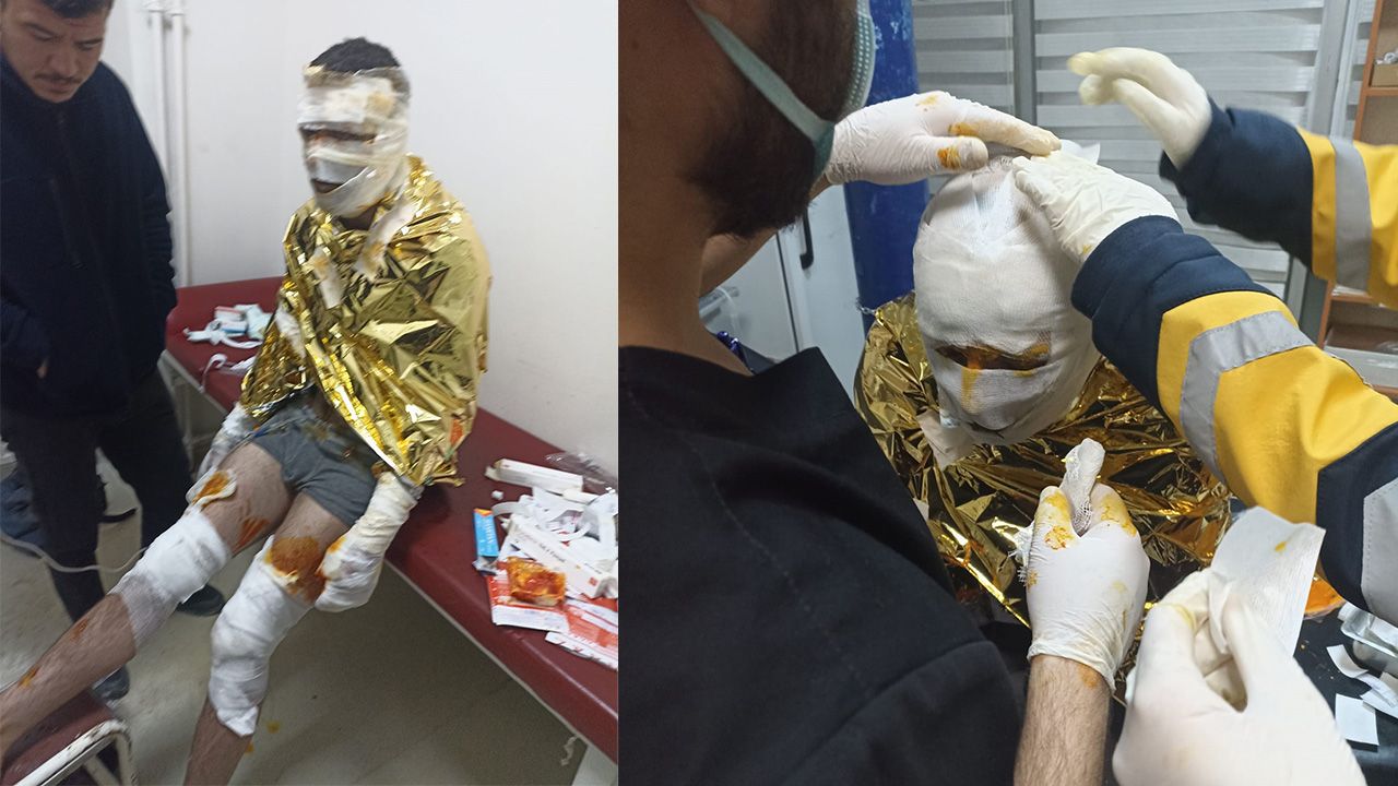 Erzurum’da Kömür Ocağında Yangın: 2 İşçi Yaralı